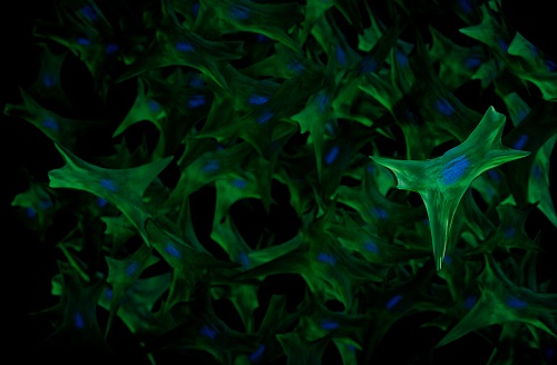NIH scientists find treatment for rare genetic skin disorder