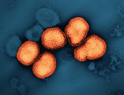 NIH clinical trial of universal flu vaccine candidate begins