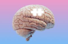Cleveland Clinic Research Finds Sex Differences in Immune Response and Metabolism Drive Alzheimer’s Disease