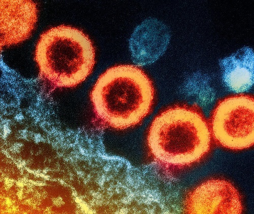 Long-acting HIV treatment demonstrates efficacy in people with challenges taking daily medicine as prescribed