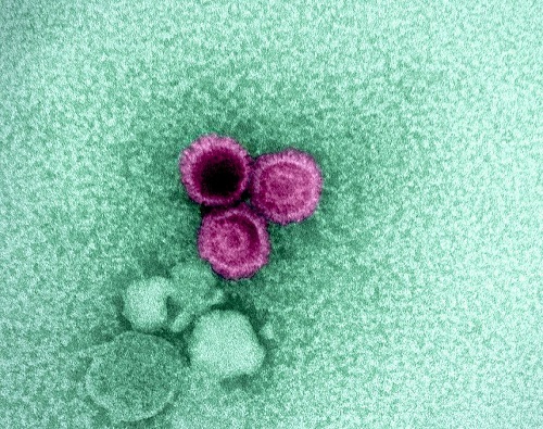 NIH scientists find weak points on Epstein-Barr virus