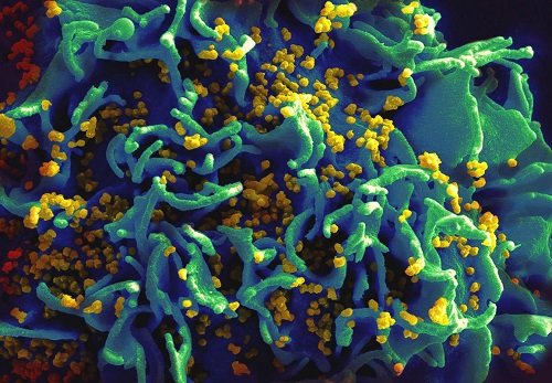 Vaginal ring and oral pre-exposure prophylaxis found safe for HIV prevention throughout pregnancy