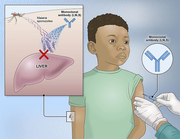 Experimental NIH malaria monoclonal antibody protective in Malian children