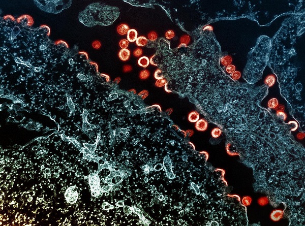 Novel vaccine concept generates immune responses that could produce multiple types of HIV broadly neutralizing antibodies