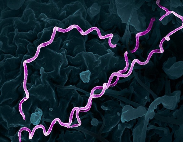 Emergency department screening more than doubles detection of syphilis cases