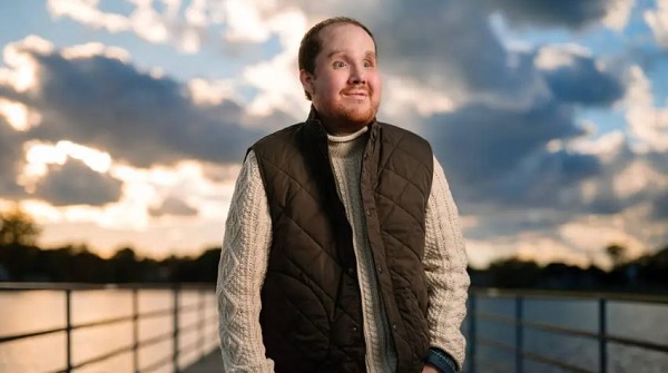 Mayo Clinic performs successful face transplant, restoring vital functions for Michigan man