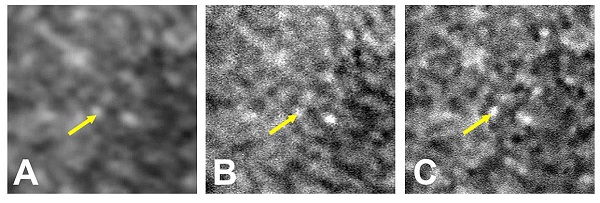 NIH researchers supercharge ordinary clinical device to get a better look at the back of the eye