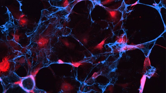A new tool to find hidden ‘zombie cells’