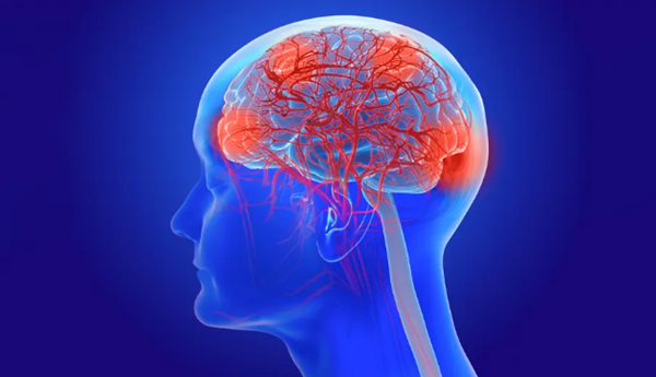A ‘major steppingstone’ against Alzheimer’s