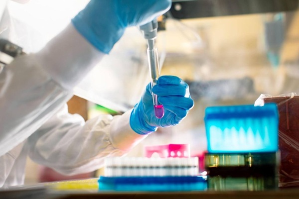 Mayo Clinic researchers use milk-derived nanoparticles to target aggressive bile duct cancer