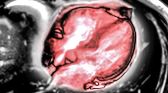 Carnegie Mellon University and Cleveland Clinic Develop AI System to Interpret Cardiac MRI Scans with Enhanced Accuracy