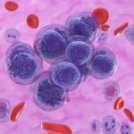 MD ANDERSON: First-in-class therapy targets “undruggable” protein in hard-to-treat blood cancers